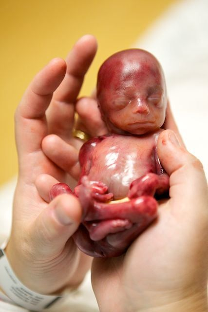 O Cristão e o Aborto – PARTE&nbsp;2